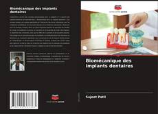 Bookcover of Biomécanique des implants dentaires