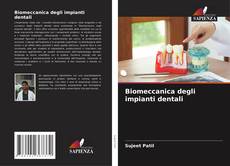 Biomeccanica degli impianti dentali的封面