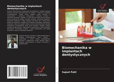 Biomechanika w implantach dentystycznych的封面