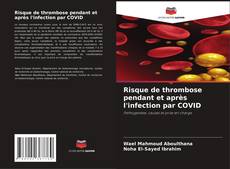 Copertina di Risque de thrombose pendant et après l'infection par COVID