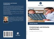 Krebsbiologie und klinische Implikationen kitap kapağı