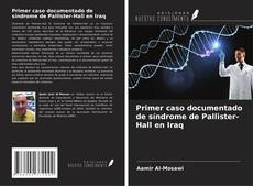 Couverture de Primer caso documentado de síndrome de Pallister-Hall en Iraq