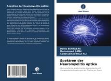 Couverture de Spektren der Neuromyelitis optica