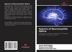Bookcover of Spectra of Neuromyelitis Optica