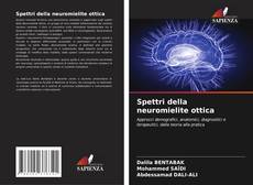 Spettri della neuromielite ottica kitap kapağı