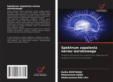 Buchcover von Spektrum zapalenia nerwu wzrokowego