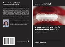 Copertina di Avances en odontología mínimamente invasiva