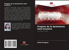 Bookcover of Progrès de la dentisterie mini-invasive