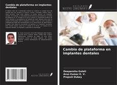 Cambio de plataforma en implantes dentales的封面