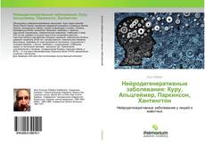 Обложка Нейродегенеративные заболевания: Куру, Альцгеймер, Паркинсон, Хантингтон