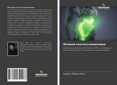 Portada del libro de Лечение толстого кишечника