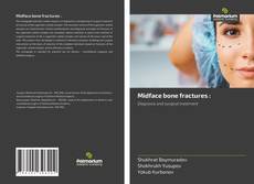 Bookcover of Midface bone fractures :