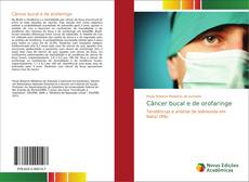 Capa do livro de Câncer bucal e de orofaringe 