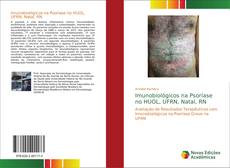 Buchcover von Imunobiológicos na Psoríase no HUOL, UFRN, Natal, RN
