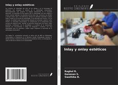 Inlay y onlay estéticos的封面