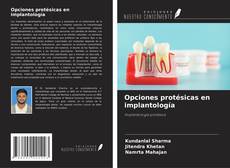 Capa do livro de Opciones protésicas en implantología 