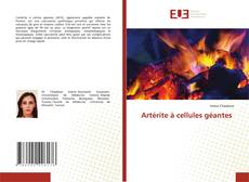 Copertina di Artérite à cellules géantes