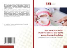 Restaurations mini-invasives collées des dents postérieures dépulpées kitap kapağı