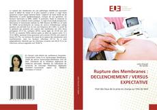Rupture des Membranes : DECLENCHEMENT / VERSUS EXPECTATIVE kitap kapağı