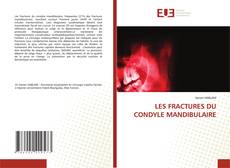 Copertina di LES FRACTURES DU CONDYLE MANDIBULAIRE