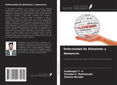 Enfermedad de Alzheimer y demencia:的封面