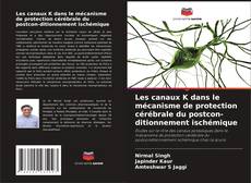 Bookcover of Les canaux K dans le mécanisme de protection cérébrale du postcon-ditionnement ischémique