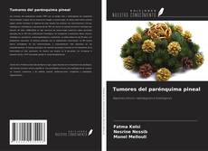 Buchcover von Tumores del parénquima pineal