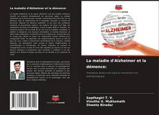Couverture de La maladie d'Alzheimer et la démence: