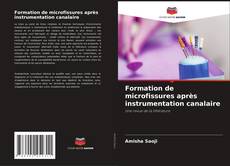 Copertina di Formation de microfissures après instrumentation canalaire