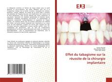 Copertina di Effet du tabagisme sur la réussite de la chirurgie implantaire