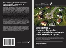 Copertina di Diagnóstico y tratamientos de los trastornos del espectro de la neuromielitis óptica
