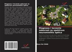 Borítókép a  Diagnoza i leczenie zaburzeń ze spektrum neuromielitis optica - hoz