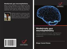 Buchcover von Niedojrzały guz neuroepitelialny