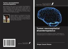 Copertina di Tumor neuroepitelial disembrioplásico