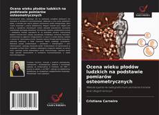 Portada del libro de Ocena wieku płodów ludzkich na podstawie pomiarów osteometrycznych