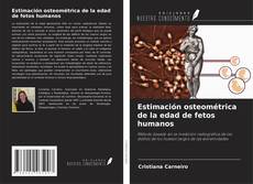 Couverture de Estimación osteométrica de la edad de fetos humanos