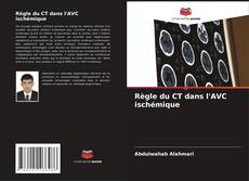 Règle du CT dans l'AVC ischémique的封面