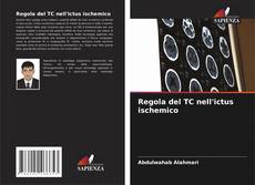 Couverture de Regola del TC nell'ictus ischemico