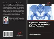 Buchcover von Najnowsze koncepcje leczenia choroby Legga-Calve'a-Perthesa