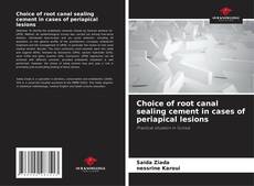Choice of root canal sealing cement in cases of periapical lesions kitap kapağı