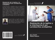 Couverture de Modulación de la leptina y la interleucina-6 por Lactobacillus acidophilus