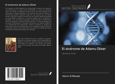 Bookcover of El síndrome de Adams Oliver