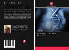 Bookcover of Síndrome de Adams Oliver