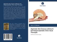 Bookcover of Agenese des Corpus callosum bei Kolpocephalie: Eine neue Therapie