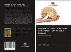 Buchcover von Agenèse du corps calleux avec colocéphalie: Une nouvelle thérapie