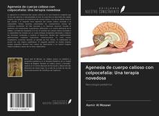 Portada del libro de Agenesia de cuerpo calloso con colpocefalia: Una terapia novedosa