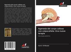 Capa do livro de Agenesia del corpo calloso con colpocefalia: Una nuova terapia 