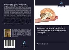 Bookcover of Agenesis van corpus callosum met colpocephalie: Een nieuwe therapie