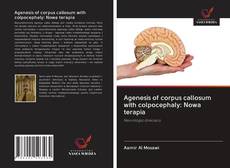 Bookcover of Agenesis of corpus callosum with colpocephaly: Nowa terapia