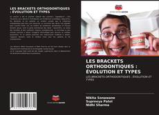 Bookcover of LES BRACKETS ORTHODONTIQUES : ÉVOLUTION ET TYPES